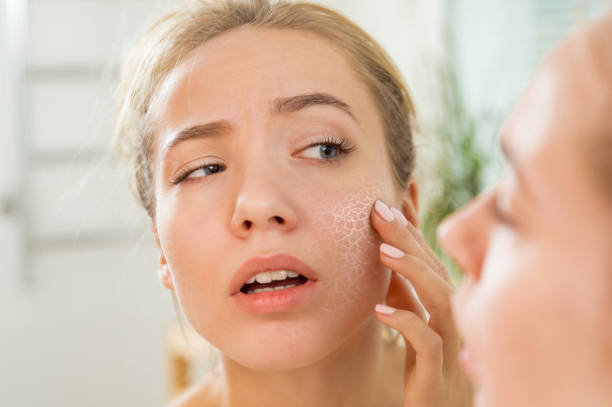 Read more about the article Dry Skin on the Face: Causes, Treatments, and More